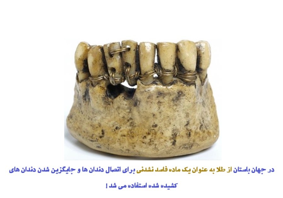 تاریخچه دندانپزشکی در ایران و جهان