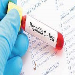 درمان هپاتیت C با داروی ایرانی