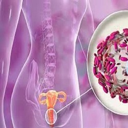 راه های درمان عفونت واژن در بارداری چگونه است؟