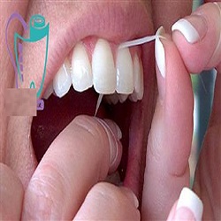 نحوه صحیح کشیدن نخ دندان چگونه است؟