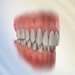 نحوه صحیح قرارگیری دندان ها چگونه است؟