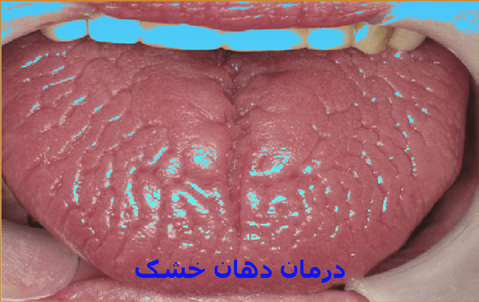 images۳